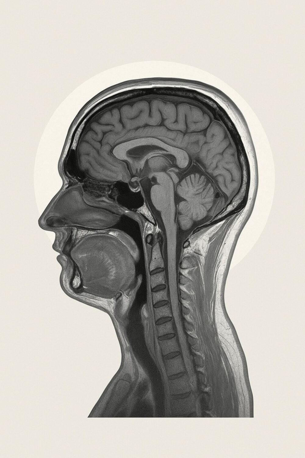mri scan hoofd